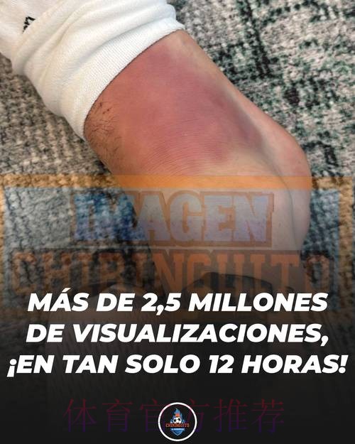 马卡报：奥德里奥索拉赛后右腿不适 今天将检查